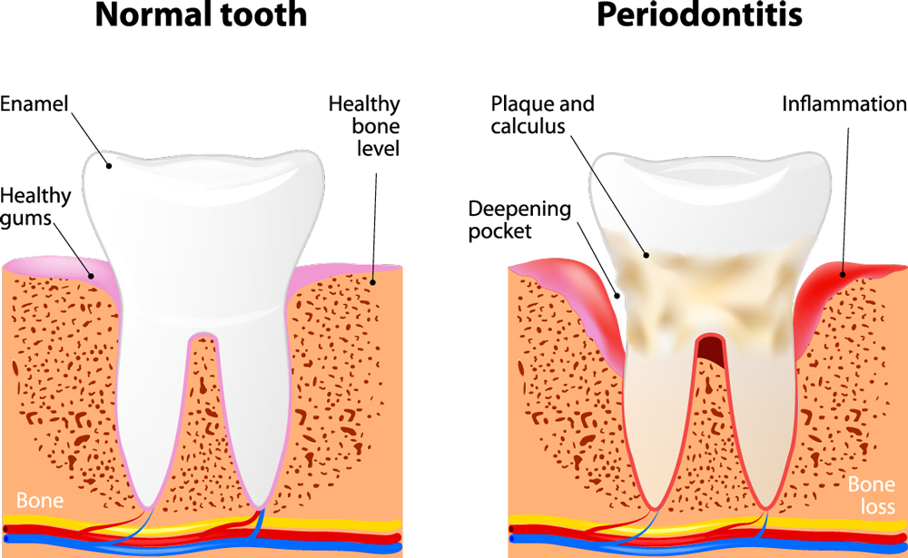 Periodontal-Care_295117064 Periodontal-Care_295117064